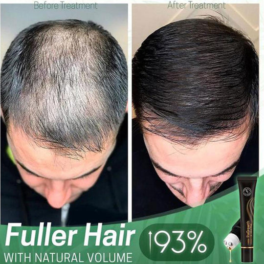 Regrowth Organic Hair Serum Roller - beumoonshop